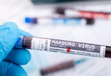 After 8 deaths in this country... a warning about the highly contagious Marburg virus!