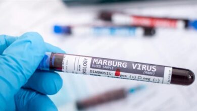 After 8 deaths in this country... a warning about the highly contagious Marburg virus!